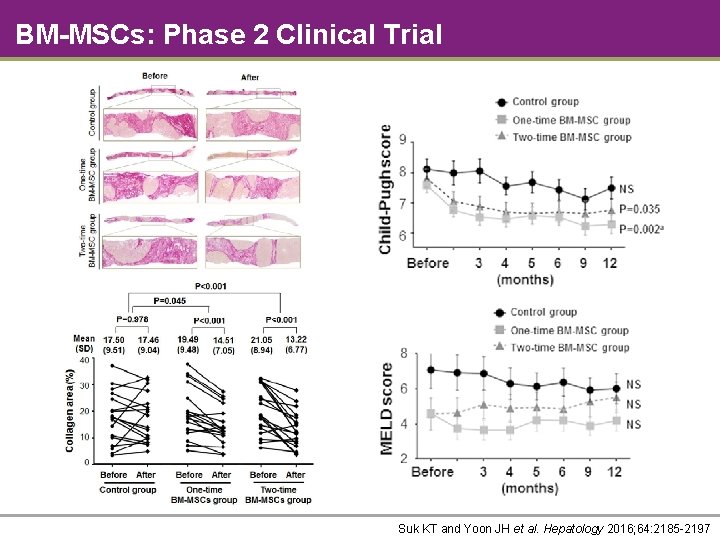 BM-MSCs: Phase 2 Clinical Trial Suk KT and Yoon JH et al. Hepatology 2016;
