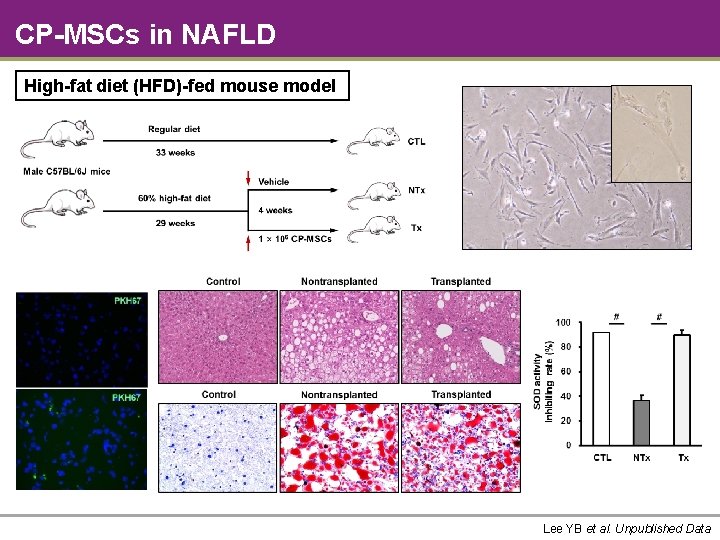 CP-MSCs in NAFLD High-fat diet (HFD)-fed mouse model Lee YB et al. Unpublished Data