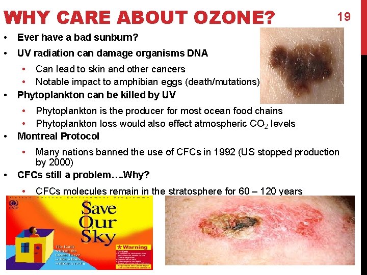 WHY CARE ABOUT OZONE? • Ever have a bad sunburn? • UV radiation can