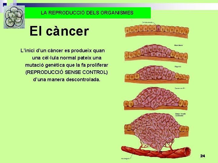 LA REPRODUCCIÓ DELS ORGANISMES El càncer L’inici d’un càncer es produeix quan una cèl·lula