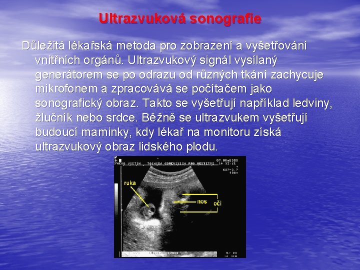 Ultrazvuková sonografie Důležitá lékařská metoda pro zobrazení a vyšetřování vnitřních orgánů. Ultrazvukový signál vysílaný