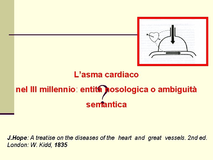 L’asma cardiaco ? nel III millennio: entità nosologica o ambiguità semantica J. Hope: A