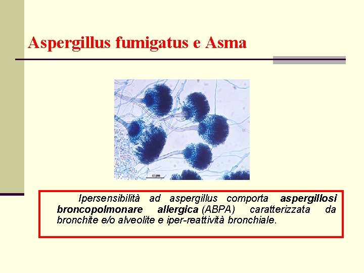 Aspergillus fumigatus e Asma Ipersensibilità ad aspergillus comporta aspergillosi broncopolmonare allergica (ABPA) caratterizzata da