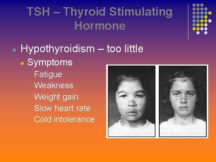 TSH – Thyroid Stimulating Hormone ● Hypothyroidism – too little ● Symptoms ▪ ▪