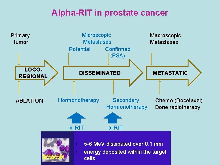 Alpha-RIT in prostate cancer Primary tumor Microscopic Metastases Potential Confirmed (PSA) LOCOREGIONAL ABLATION DISSEMINATED
