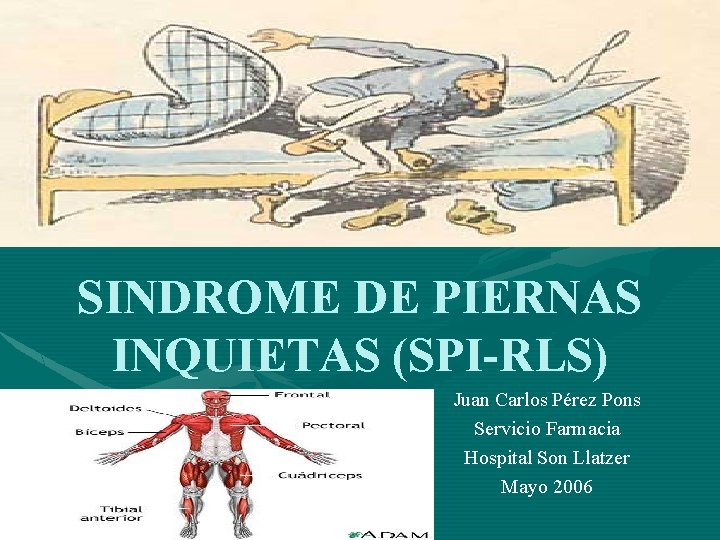 SINDROME DE PIERNAS INQUIETAS (SPI-RLS) Juan Carlos Pérez Pons Servicio Farmacia Hospital Son Llatzer