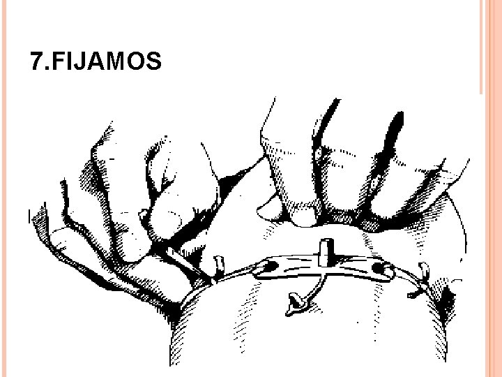7. FIJAMOS 12 7. FIJAMOS 12