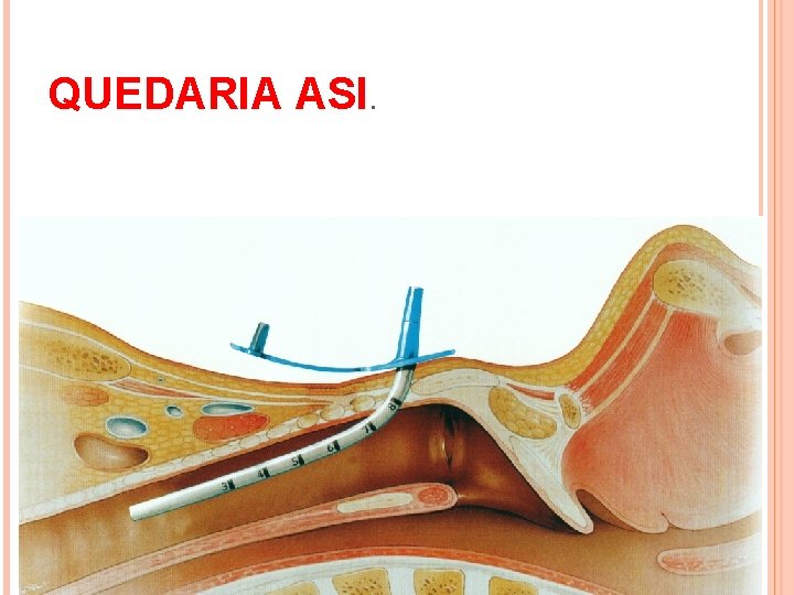 QUEDARIA ASI. QUEDARIA ASI.