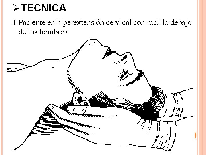 ØTECNICA 1. Paciente en hiperextensión cervical con rodillo debajo de los hombros. ØTECNICA 1. Paciente en hiperextensión cervical con rodillo debajo de los hombros.