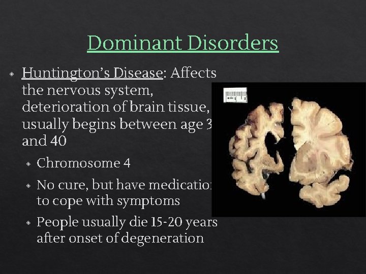 Dominant Disorders ◈ Huntington’s Disease: Affects the nervous system, deterioration of brain tissue, usually