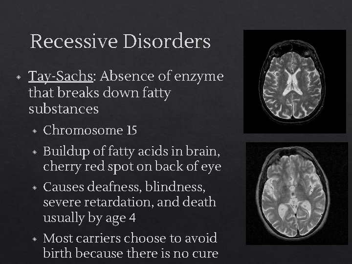 Recessive Disorders ◈ Tay-Sachs: Absence of enzyme that breaks down fatty substances ◈ Chromosome