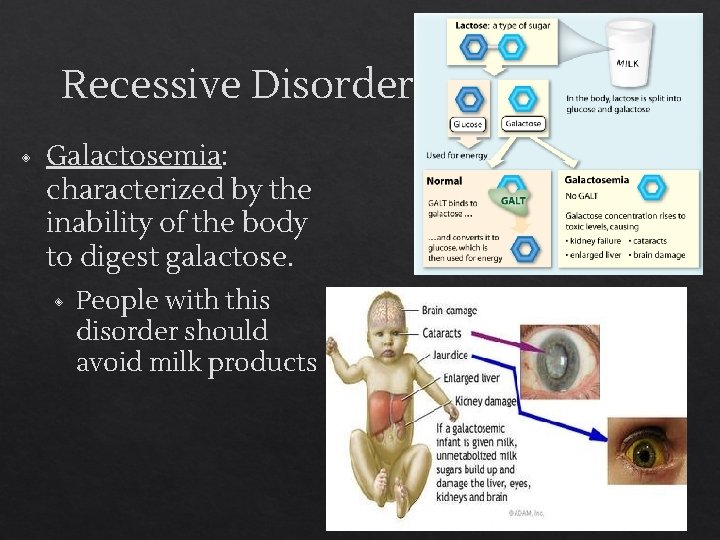Recessive Disorders ◈ Galactosemia: characterized by the inability of the body to digest galactose.