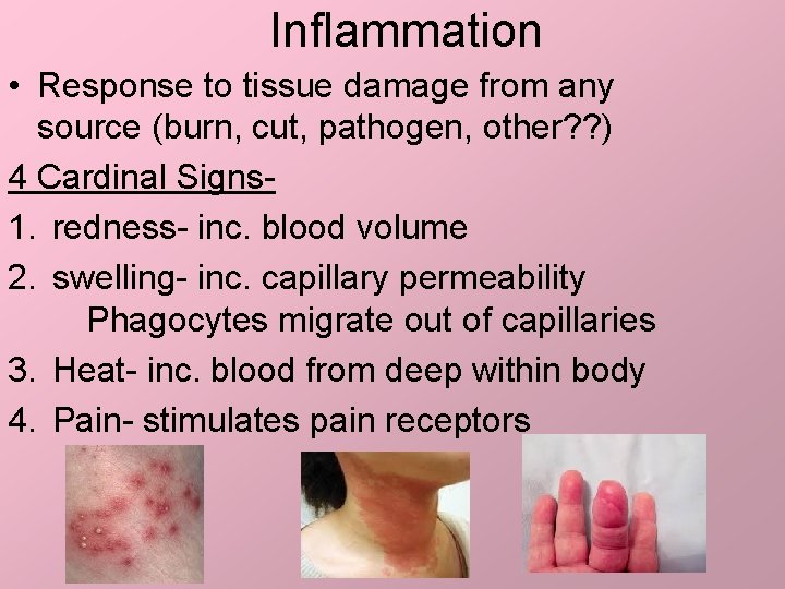 Inflammation • Response to tissue damage from any source (burn, cut, pathogen, other? ?