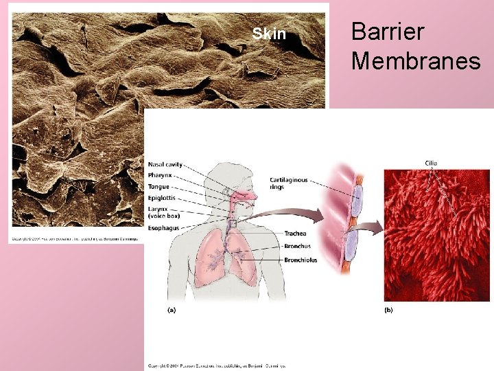 Skin Barrier Membranes 