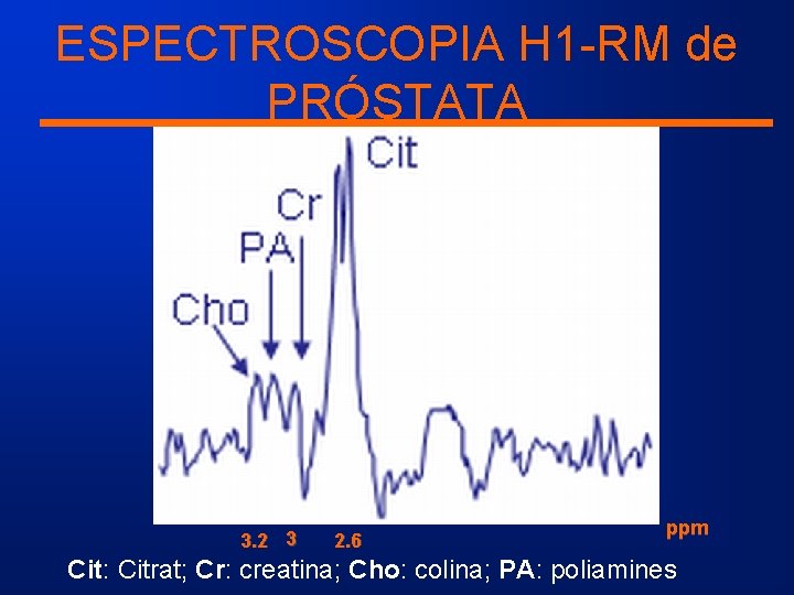 ESPECTROSCOPIA H 1 -RM de PRÓSTATA 3. 2 3 2. 6 ppm Cit: Citrat;