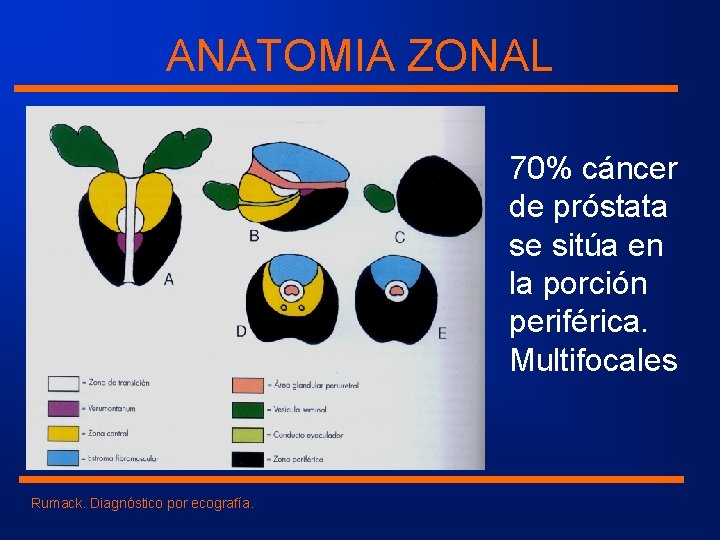 ANATOMIA ZONAL 70% cáncer de próstata se sitúa en la porción periférica. Multifocales Rumack.