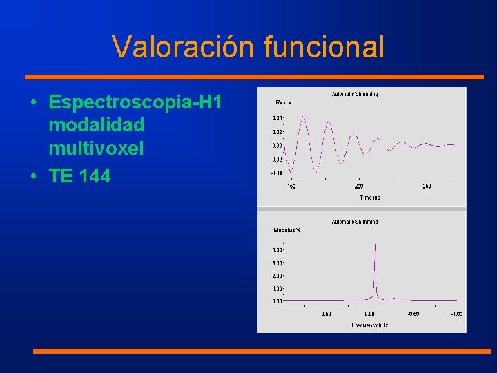 Valoración funcional • Espectroscopia-H 1 modalidad multivoxel • TE 144 