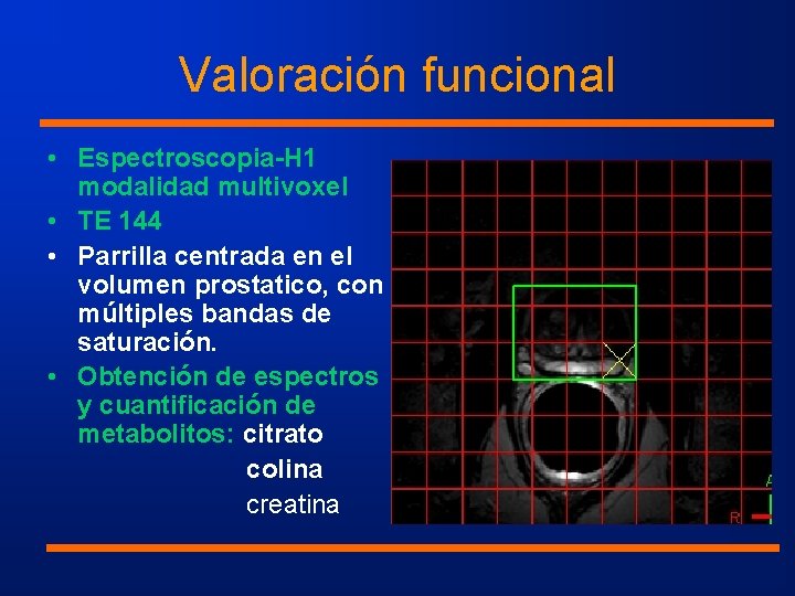 Valoración funcional • Espectroscopia-H 1 modalidad multivoxel • TE 144 • Parrilla centrada en