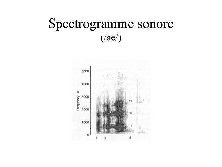 Spectrogramme sonore (/ae/) 