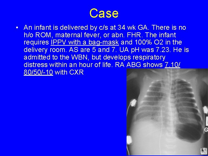 Case • An infant is delivered by c/s at 34 wk GA. There is