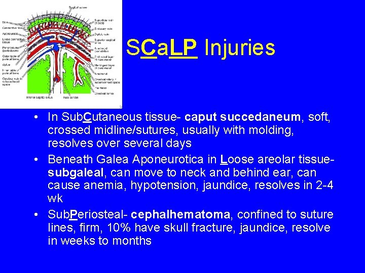 SCa. LP Injuries • In Sub. Cutaneous tissue- caput succedaneum, soft, crossed midline/sutures, usually