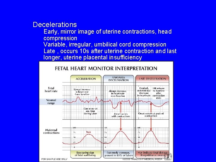 Decelerations Early, mirror image of uterine contractions, head compression Variable, irregular, umbilical cord compression