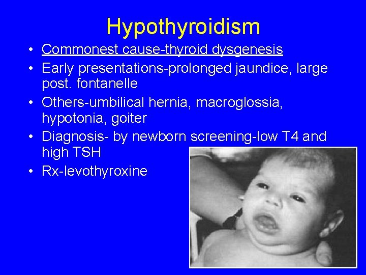 Hypothyroidism • Commonest cause-thyroid dysgenesis • Early presentations-prolonged jaundice, large post. fontanelle • Others-umbilical