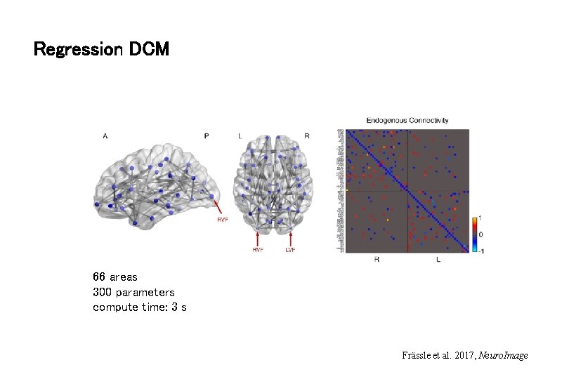 Regression DCM 66 areas 300 parameters compute time: 3 s Frässle et al. 2017,