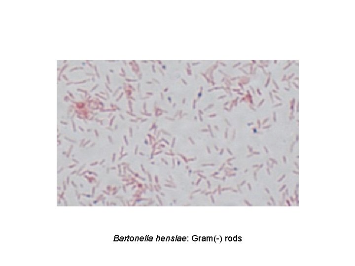 Bartonella henslae: Gram(-) rods 