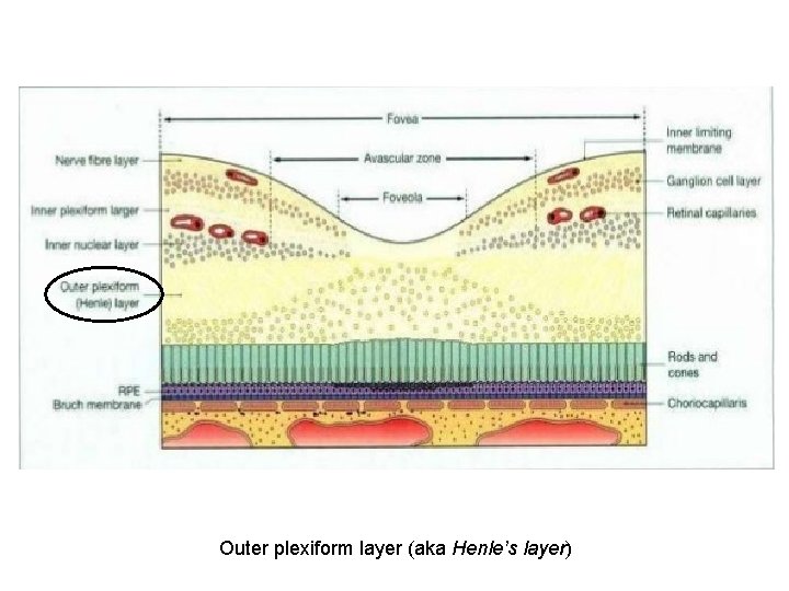 Outer plexiform layer (aka Henle’s layer) 