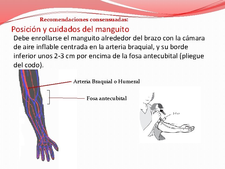 Recomendaciones consensuadas: Posición y cuidados del manguito Debe enrollarse el manguito alrededor del brazo