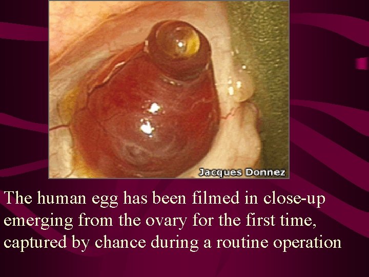 The human egg has been filmed in close-up emerging from the ovary for the