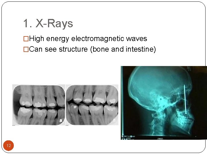 1. X-Rays �High energy electromagnetic waves �Can see structure (bone and intestine) 12 1. X-Rays �High energy electromagnetic waves �Can see structure (bone and intestine) 12