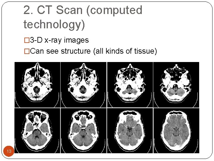 2. CT Scan (computed technology) � 3 -D x-ray images �Can see structure (all 2. CT Scan (computed technology) � 3 -D x-ray images �Can see structure (all