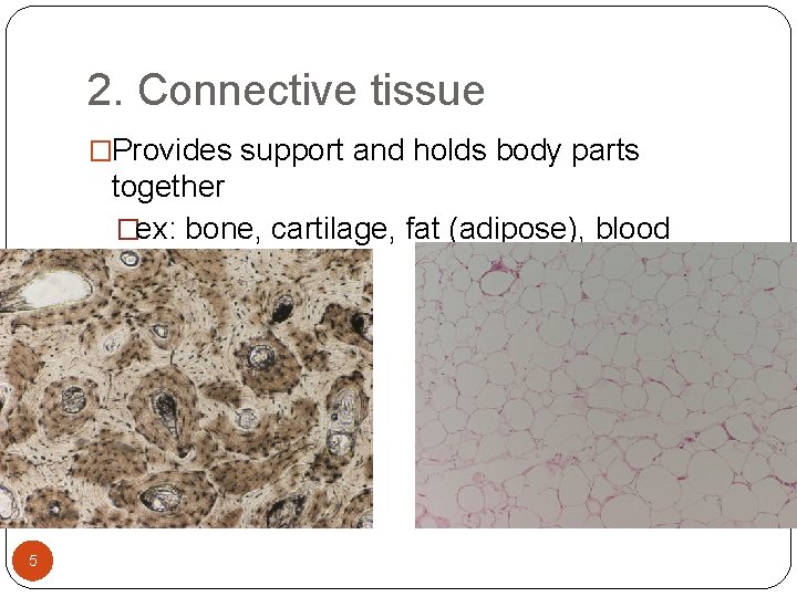 2. Connective tissue �Provides support and holds body parts together �ex: bone, cartilage, fat 2. Connective tissue �Provides support and holds body parts together �ex: bone, cartilage, fat