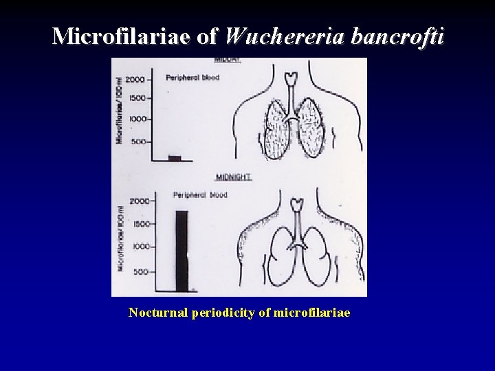 Microfilariae of Wuchereria bancrofti Nocturnal periodicity of microfilariae 