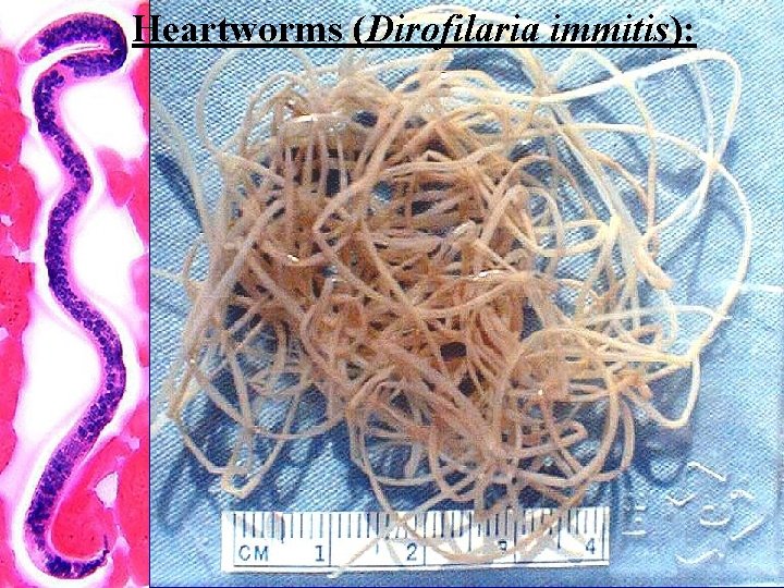 Heartworms (Dirofilaria immitis): 
