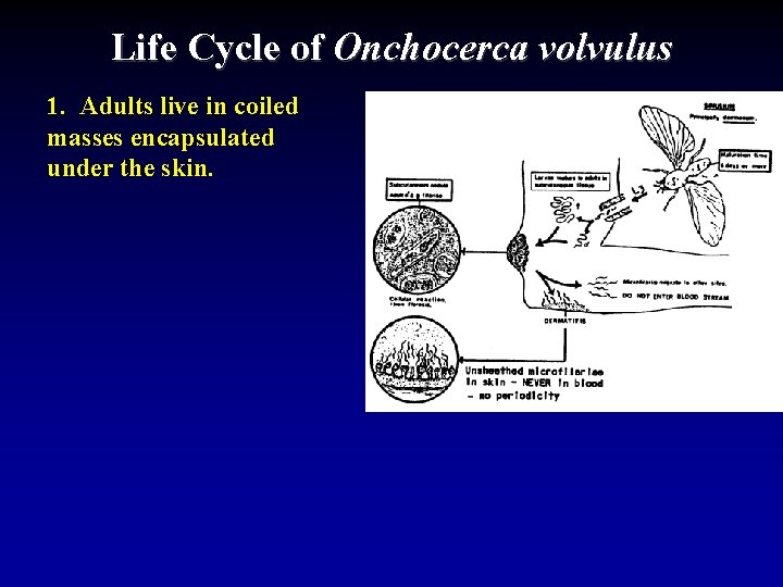 Life Cycle of Onchocerca volvulus 1. Adults live in coiled masses encapsulated under the