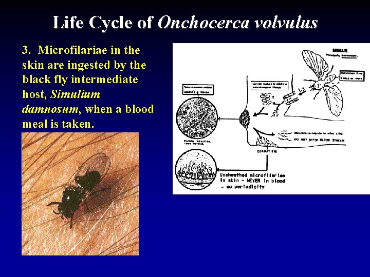 Life Cycle of Onchocerca volvulus 3. Microfilariae in the skin are ingested by the