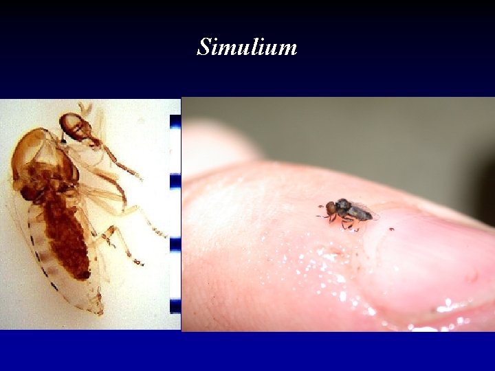 Simulium 