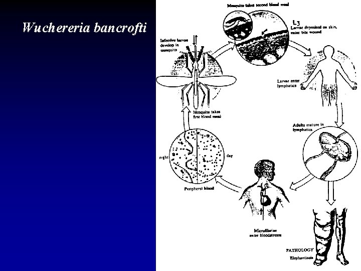 Wuchereria bancrofti 