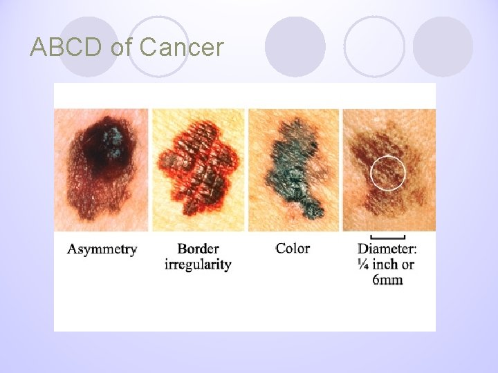 ABCD of Cancer 