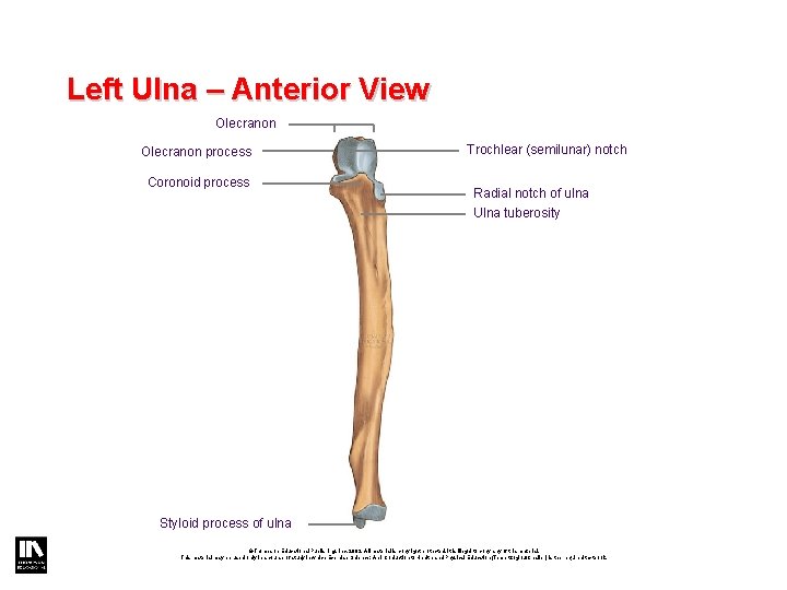 Left Ulna – Anterior View Olecranon process Coronoid process Trochlear (semilunar) notch Radial notch Left Ulna – Anterior View Olecranon process Coronoid process Trochlear (semilunar) notch Radial notch