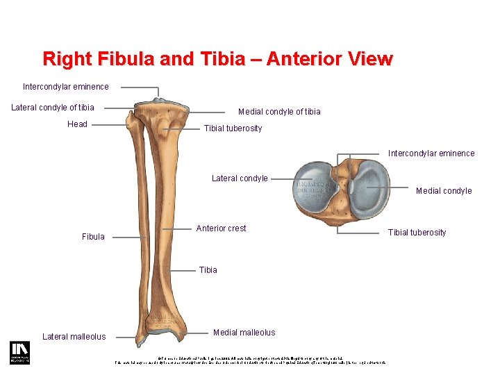 Right Fibula and Tibia – Anterior View Intercondylar eminence Lateral condyle of tibia Head Right Fibula and Tibia – Anterior View Intercondylar eminence Lateral condyle of tibia Head