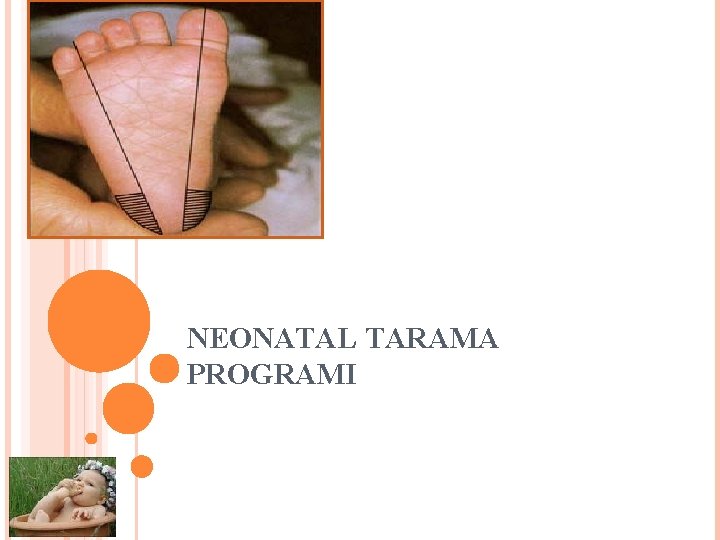 NEONATAL TARAMA PROGRAMI 