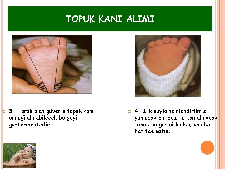 TOPUK KANI ALIMI 3. Taralı alan güvenle topuk kanı örneği alınabilecek bölgeyi göstermektedir 4.