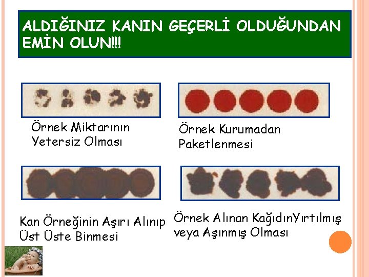 ALDIĞINIZ KANIN GEÇERLİ OLDUĞUNDAN EMİN OLUN!!! Örnek Miktarının Yetersiz Olması Örnek Kurumadan Paketlenmesi Kan