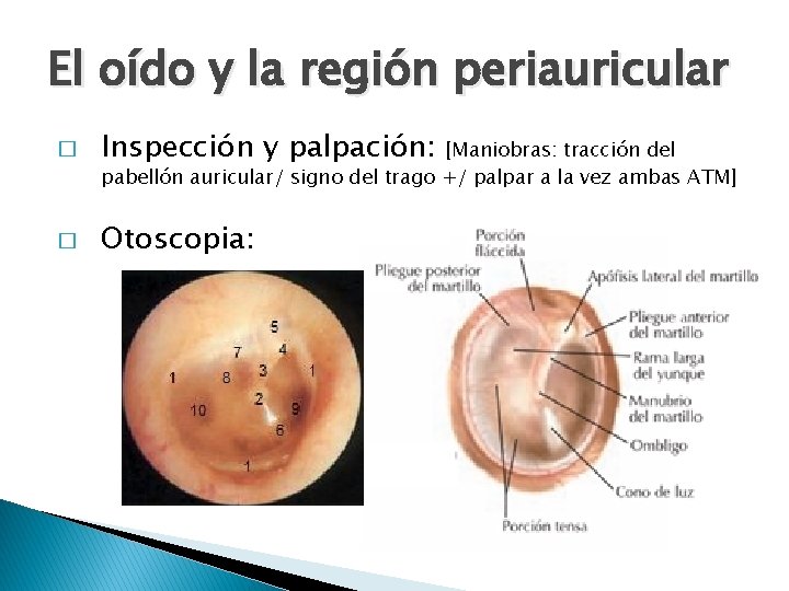 El oído y la región periauricular � Inspección y palpación: � Otoscopia: [Maniobras: tracción