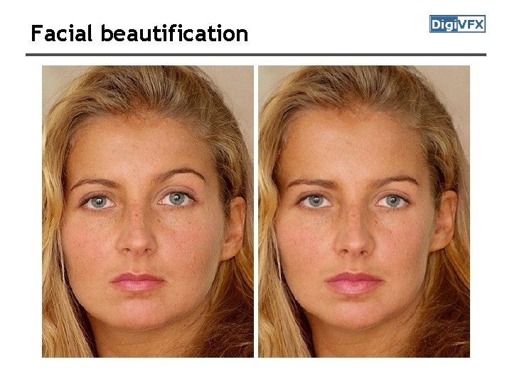 Facial beautification 