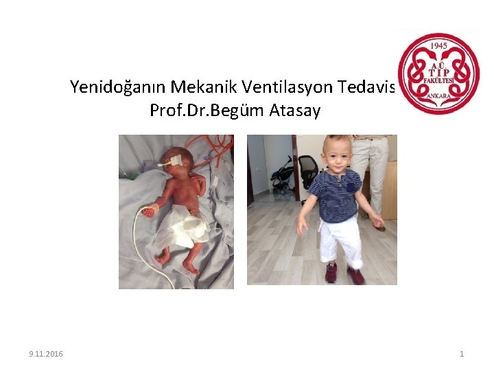 Yenidoğanın Mekanik Ventilasyon Tedavisi Prof. Dr. Begüm Atasay 9. 11. 2016 1 
